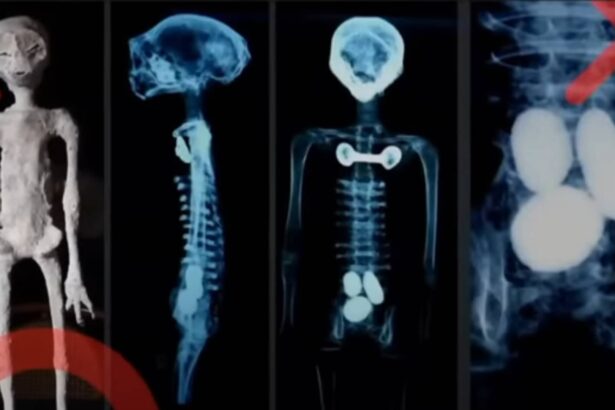X-ray analysis of the alleged alien mummy