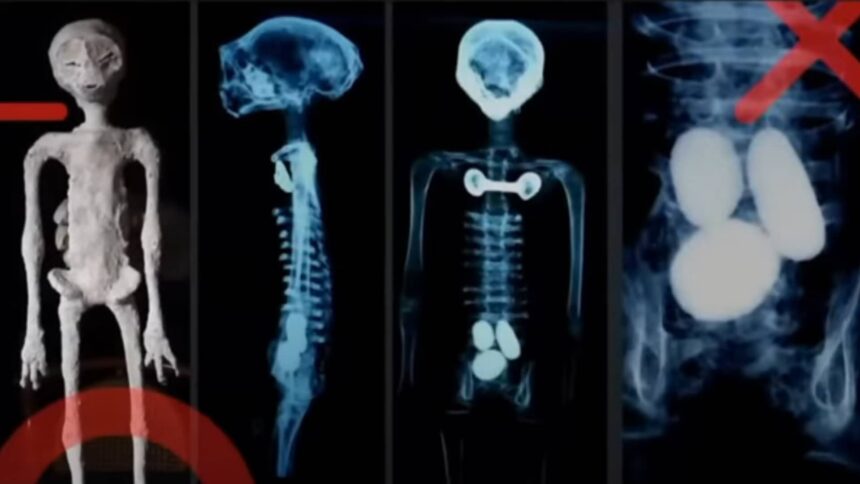 X-ray analysis of the alleged alien mummy